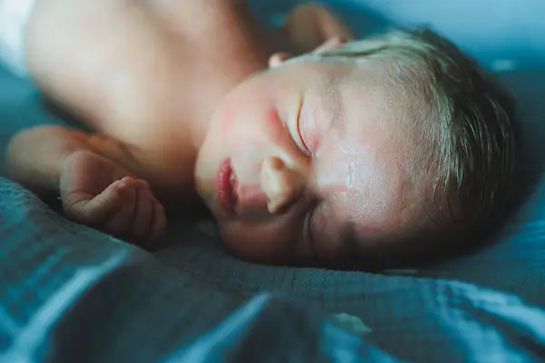 stock image The baby is sleeping. A newborn baby is sleeping. Baby with dry skin