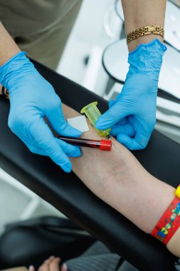 Hemşire bir hastanın damarından kan toplar. Araştırma için bir kadından kan almak..
