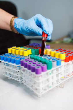Kanlı test tüpleri. Araştırma için damardan kan alıyorum.