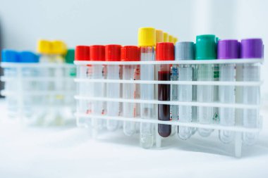 Kanlı test tüpleri. Araştırma için damardan kan alıyorum.