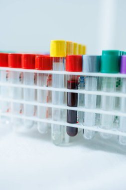 Kanlı test tüpleri. Araştırma için damardan kan alıyorum.