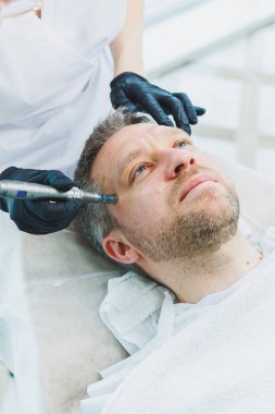 Güzellik uzmanı spa salonunda bir adamın yüzüne maske yapar. İşlem sırasında erkek yüzünün yan görüntüsü. Deride sivilceler ve sivilceler. Bir erkeğin yüzü için iğne