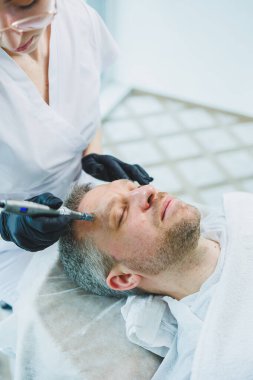 Güzellik uzmanı spa salonunda bir adamın yüzüne maske yapar. İşlem sırasında erkek yüzünün yan görüntüsü. Deride sivilceler ve sivilceler. Bir erkeğin yüzü için iğne