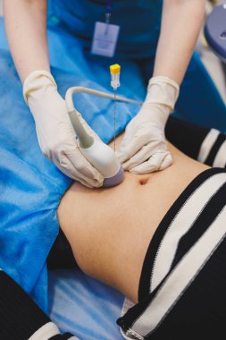 Hamilelik ultrasonu sırasında doktorun yanında yatan kadın. Hamilelik sırasında hamile kadını kontrol etmek.