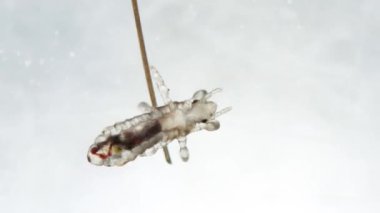 İnsan saçının tepesindeki baş belası. Duruşmada yürüyüp gitmek. İnsan parazitinin aşırı yakın plan detayları. Pedikülüs kapititi. İnsan bulaşıcı hastalıklar.