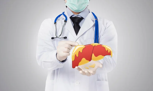 医生显示肥胖的肝脏 白色背景的肝病 — 图库照片