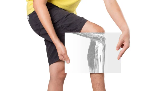 Leg Muscle Pain White Background Scan Leg Injury — Stock Photo, Image