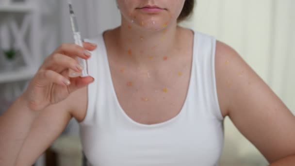 Wanita Serius Yang Tidak Dikenali Dengan Ruam Monkeypox Menunjukkan Suntikan — Stok Video