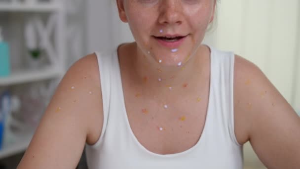 Mulher Com Varíola Tosse Exantema Câmara Lenta Sentado Dentro Casa — Vídeo de Stock