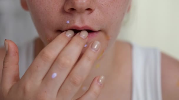 水痘の発疹が遅い動きで手で唇に触れる若い女性のクローズアップ フロントビュー白人病の女性は ウイルス感染症の症状と屋内に座って — ストック動画