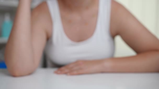 Mujer Borrosa Sentada Mesa Colocando Mano Con Sarpullido Viruela Para — Vídeos de Stock