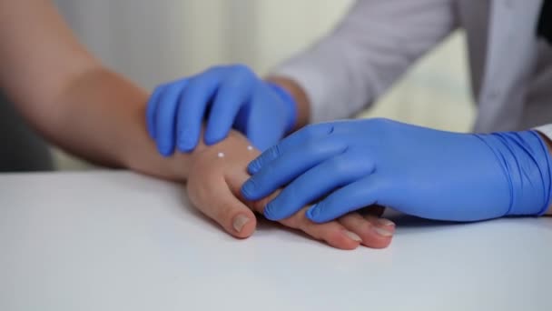 Крупным Планом Руки Врача Перчатках Исследуют Сыпь Оспы Женской Руке — стоковое видео