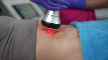 Bir kozmetolojistin hastaların karnına LED cihazıyla vakum masajı yaptığı yakın çekim. Estetik vücut şekillendirme tedavisi sırasında deri jelle kaplıdır..