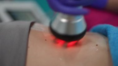 Gelişmiş cilt sağlığı ve güzelliği için gelişmiş lazer tedavisinin canlandırıcı ve canlandırıcı etkilerini tecrübe edin.