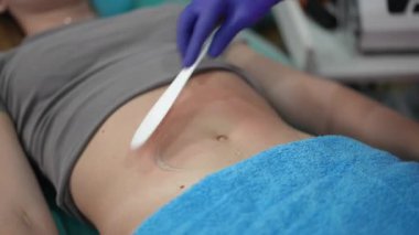Klinikteki vakum tedavisi sonrası karnı kızaran kadınlara sakinleştirici bir ürün yaymak için spatula kullanan eldivenli bir kozmetik uzmanının yakın çekimi..