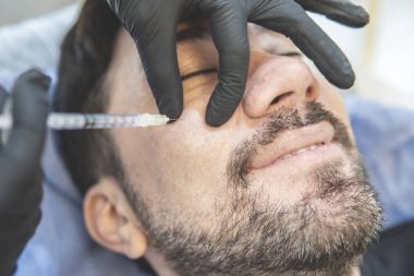 Latin adam estetik kliniğinde doldurucu iğneler yaptırıyor.