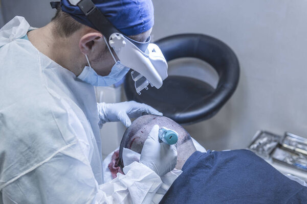 Hair transplant. Surgeons in the operating room carry out hair transplant surgery.