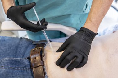 Doctor applying anesthesia to a patient's abdomen clipart