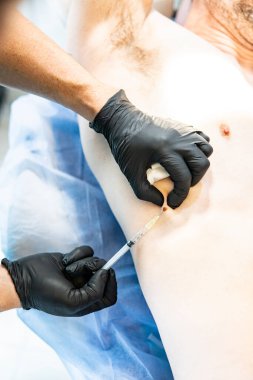 Doktor çıkarmak için siğile anestezi uyguluyor.