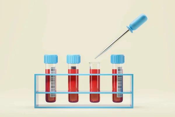 Pohled Stojan Zkumavkami Krevními Vzorky Čárovými Kódy Zdravotnickým Kapátkem Přes — Stock fotografie
