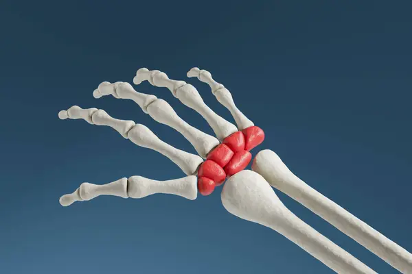 Menschliches Handskelett Mit Schmerzen Handgelenk Dunkelblauer Hintergrund Konzept Des Karpaltunnelsyndroms — Stockfoto