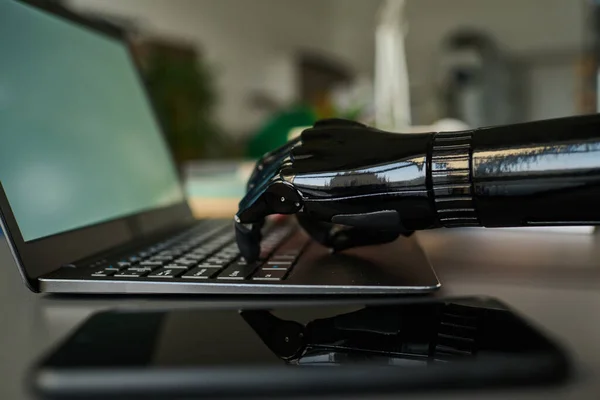 Close-up of business person with prosthetic arm working online typing on laptop at table