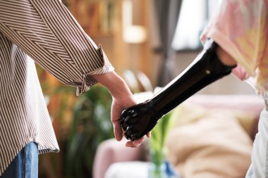 Protez kollu arkadaşıyla el ele tutuşan bir kadın. Zor bir durumda onu destekliyor.