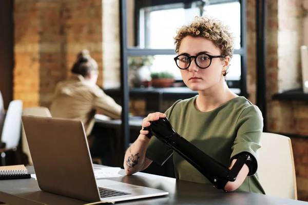 Portrait Young Woman Eyeglasses Prosthetic Arm Sitting Her Workplace Laptop — Stock Photo, Image