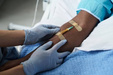 Koğuşta yatarken hastanın koluna kateter yerleştiren hemşirenin yakın çekimi.