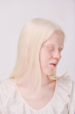 Beyaz uzun saçlı ve doğal güzelliği olan genç albino bir kadının portresi.