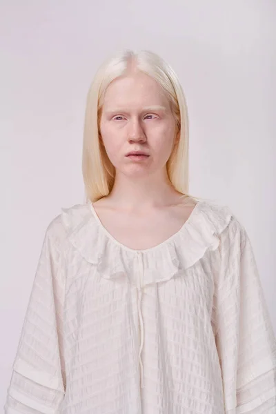 Портрет Молодої Альбінової Дівчини Білим Волоссям Стоїть Білому Тлі — стокове фото