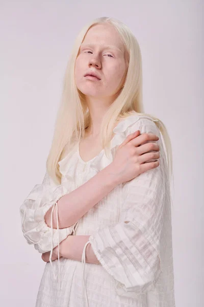 Beyaz Arkaplana Karşı Kameraya Poz Veren Güzel Albino Modelinin Portresi — Stok fotoğraf