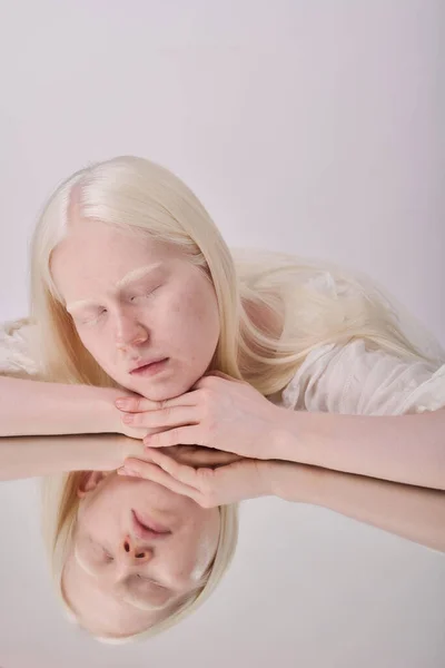 Albino Menina Com Cabelos Brancos Olhando Para Espelho Contra Fundo — Fotografia de Stock