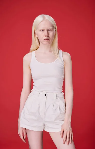 Portret Van Albino Jonge Vrouw Met Natuurlijke Schoonheid Staan Tegen — Stockfoto