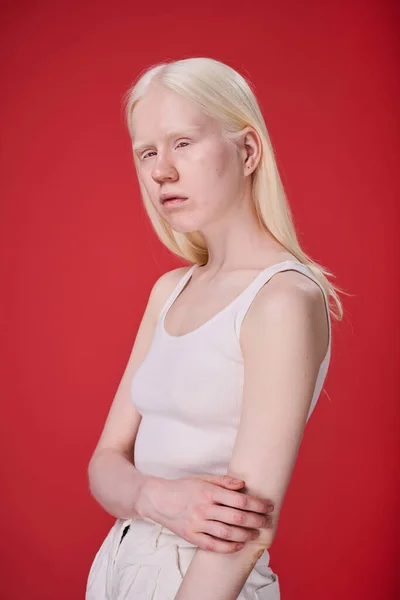 Kırmızı Arka Planda Poz Veren Alışılmadık Görünümlü Albino Kız Portresi — Stok fotoğraf