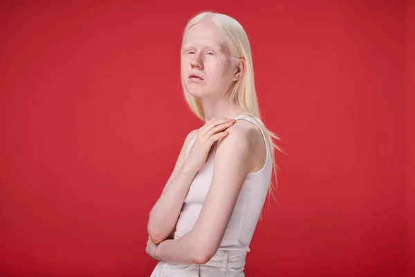 Retrato Chica Albina Con Aspecto Inusual Belleza Natural Pie Sobre — Foto de Stock