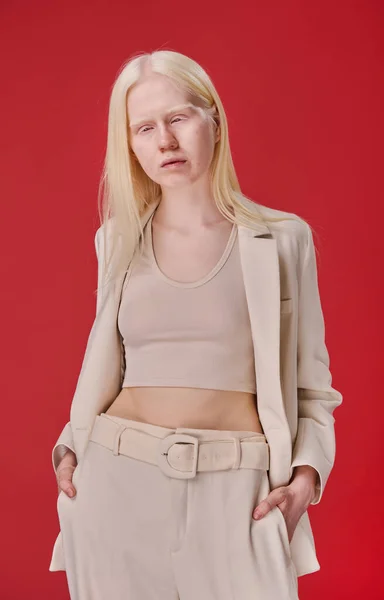 Retrato Jovem Albino Menina Terno Elegante Posando Câmera Contra Fundo — Fotografia de Stock
