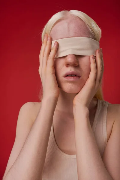 Πορτρέτο Του Νεαρό Κορίτσι Albino Δεμένα Μάτια Απομονώνονται Κόκκινο Φόντο — Φωτογραφία Αρχείου