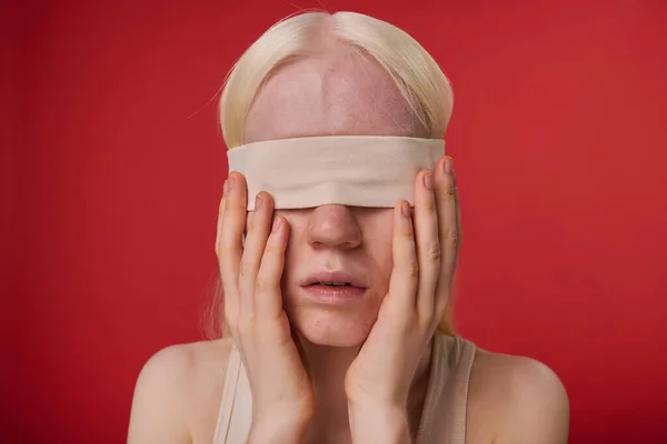 stock image Portrait of young albino girl with bandage on her eyes isolated on red background