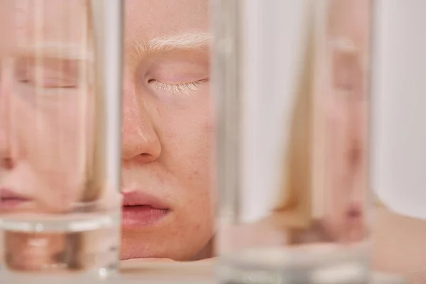 Close Albino Jovem Com Olhos Fechados Posando Com Copos Água — Fotografia de Stock