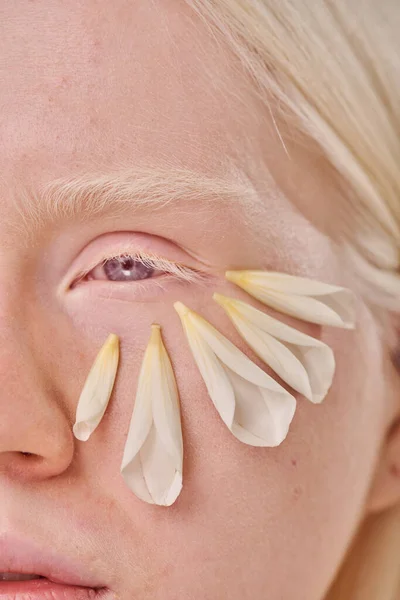 Close Menina Albina Com Olhos Azuis Pétalas Flores Sua Pele — Fotografia de Stock