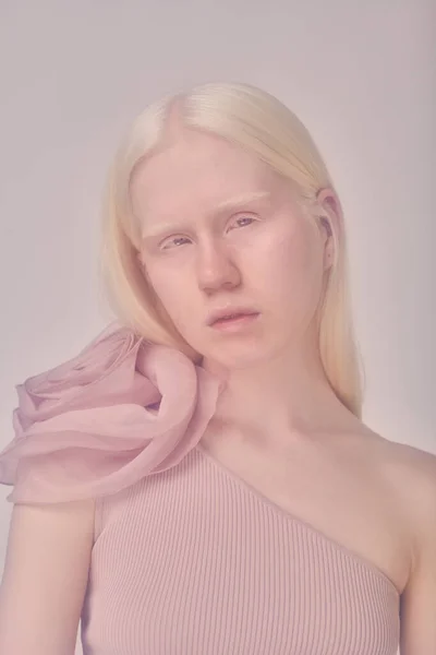 Retrato Albino Jovem Com Cabelos Longos Brancos Vestido Elegante Olhando — Fotografia de Stock