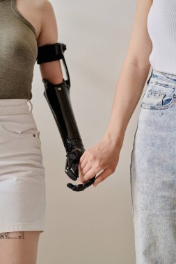 Kız arkadaşıyla el ele tutuşan protez kollu genç kızın dikey görüntüsü.