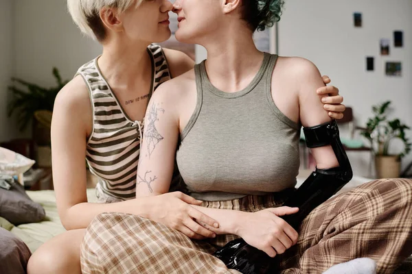 Young girl with prosthetic arm kissing her girlfriend while they sitting on bed at home