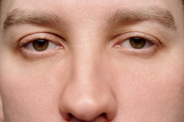 Orta heterokromi ve genç beyaz bir adamın burnu ile göz fotografı.