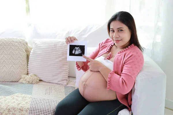 Glücklich Lächelnde Junge Schwangere Asiatin Die Auf Dem Sofa Wohnzimmer — Stockfoto