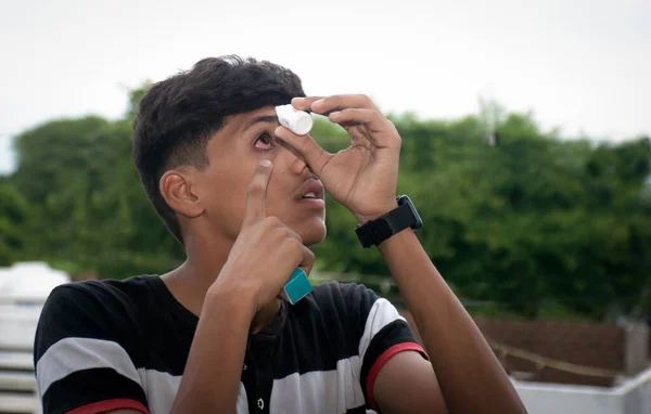 Grypa Oka Ostre Zapalenie Spojówek Pacjent Azjatycki Zaczerwienione Oczy Odczuwa Zdjęcie Stockowe