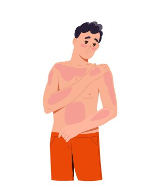Güneş yanığı insan konsepti. Vücudunda kırmızı lekeler olan bir adam. Deri sorunları ve hastalıkları olan genç bir adam. Web sitesi için grafik ögesi. Çizgi film düz vektör çizimi beyaz arkaplanda izole edildi