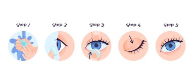 Lenslerin nasıl düzgün yerleştirildiğini. Optometik ve optalmoloji. Doğru görüş için eğitici adımlar. Sağlık ve ilaç. Çizgi film düz vektör koleksiyonu beyaz arkaplanda izole edildi