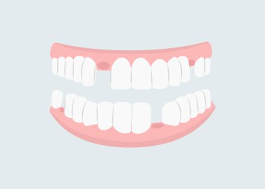 Mouth with teeth concept. Oral hygiene and cleanliness, stomatology. Problems with teeth. Health care and treatment. Poster or banner. Cartoon flat vector illustration isolated on grey background clipart
